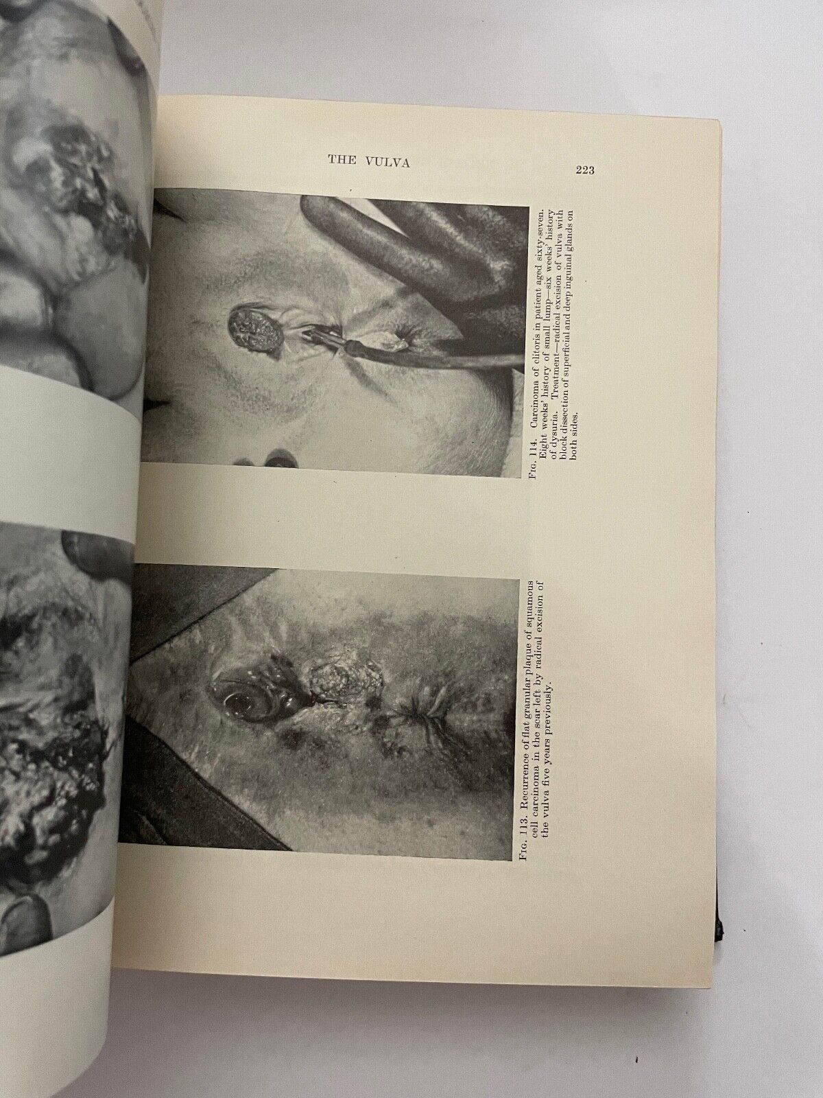 British Obstetric and Gynaecological Practice by Eardley Holland