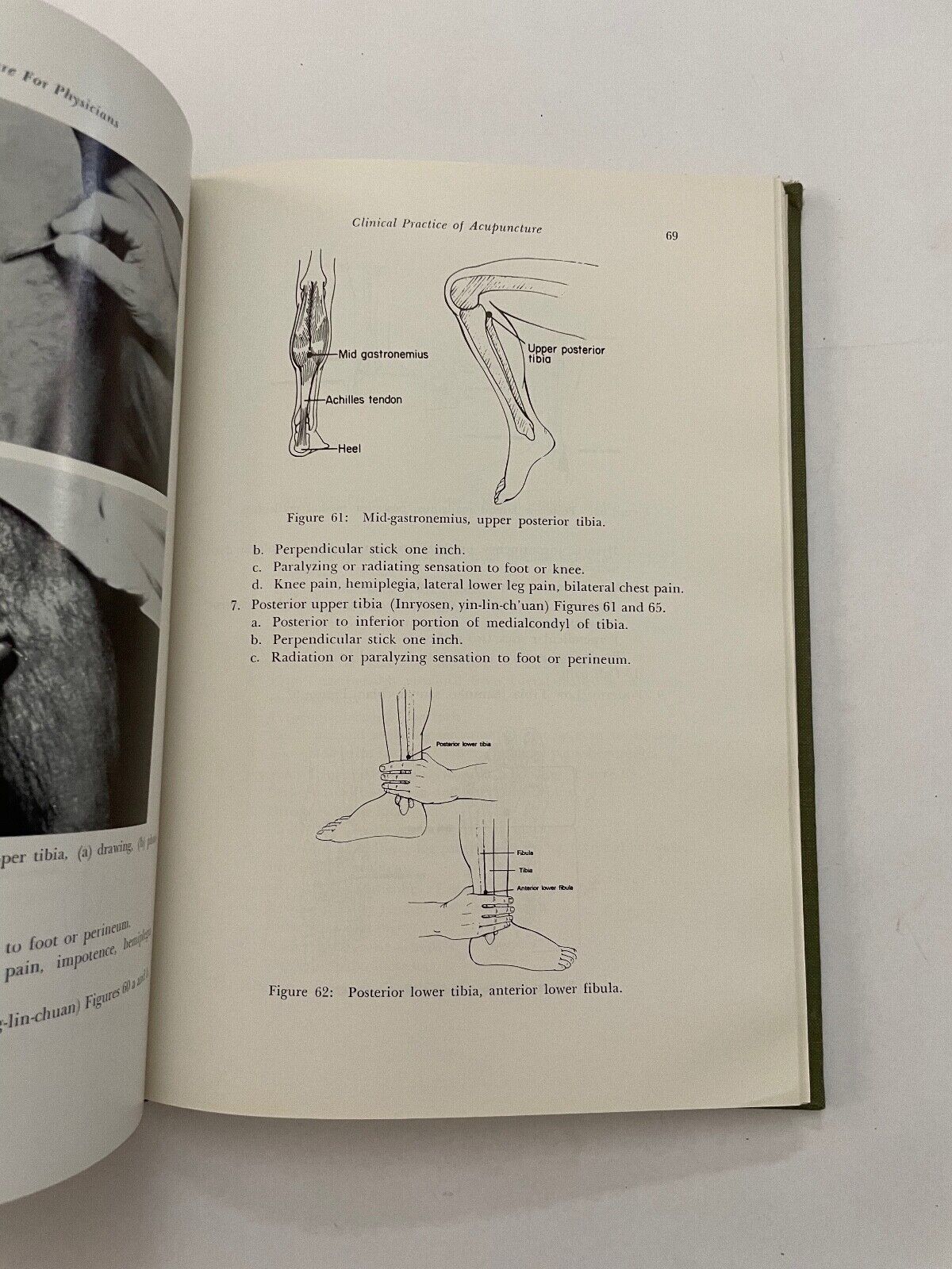 Acupuncture for Physicians by Teruo Matsumoto