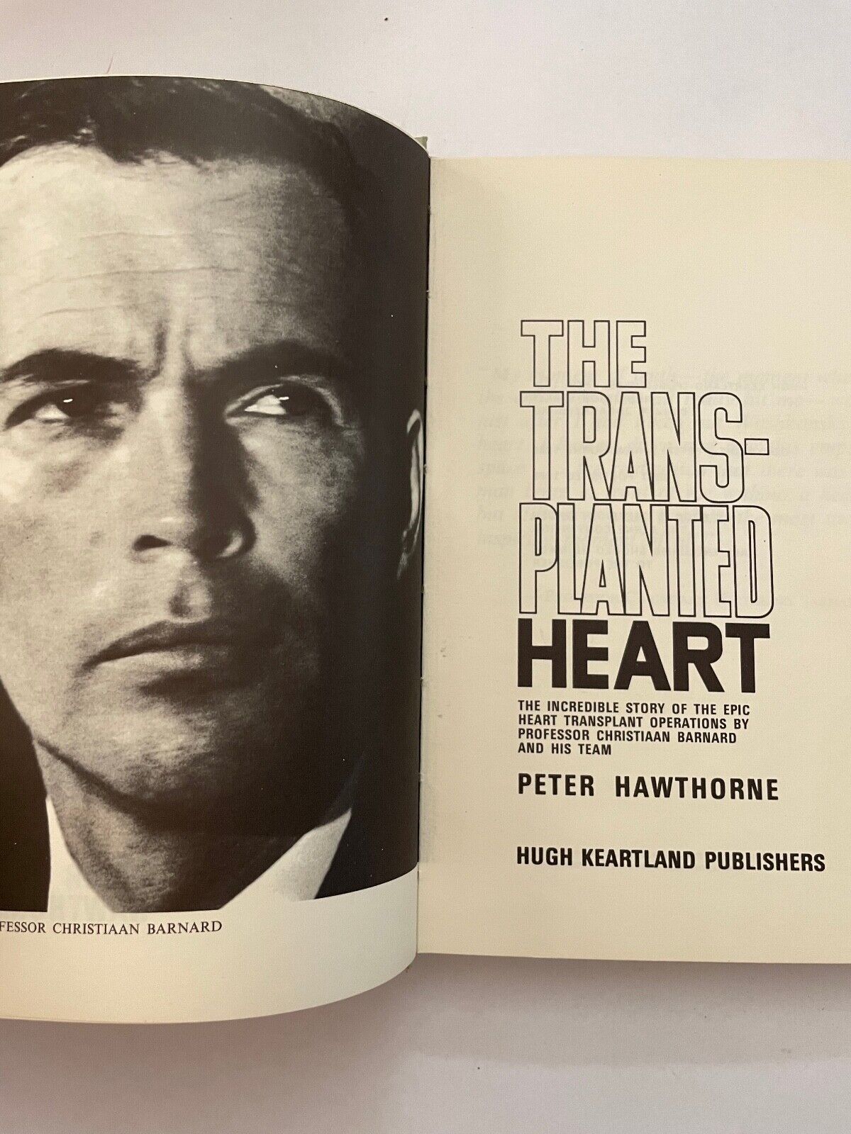 The Transplanted heart by Peter Hawthorne