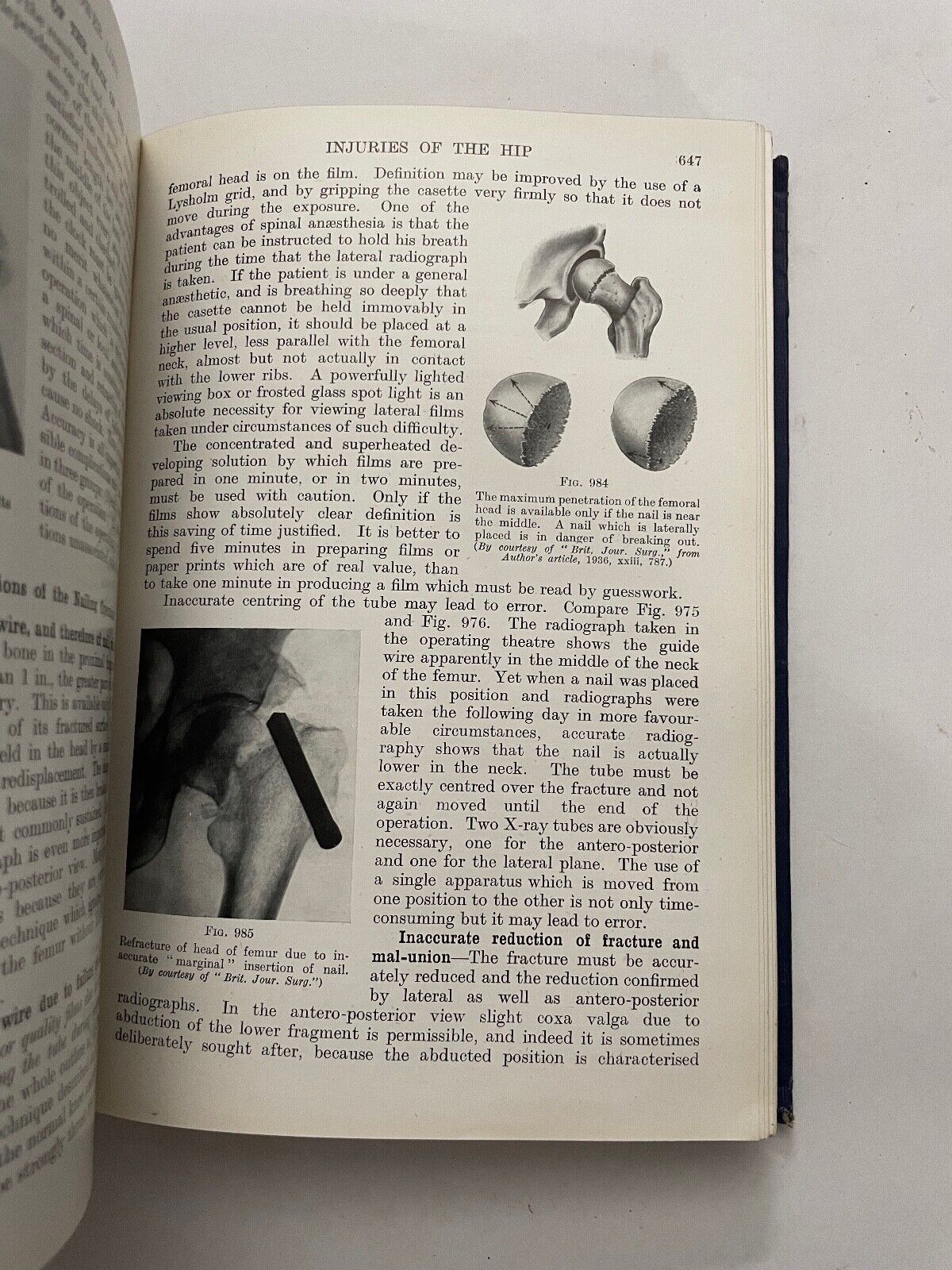 Fractures and Joint Injuries by Reginald Watson-Jones