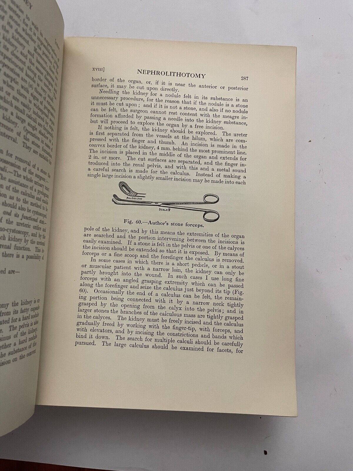Surgical Diseases and Injuries of the Genito-Urinary Organs by J Thomson-Walker