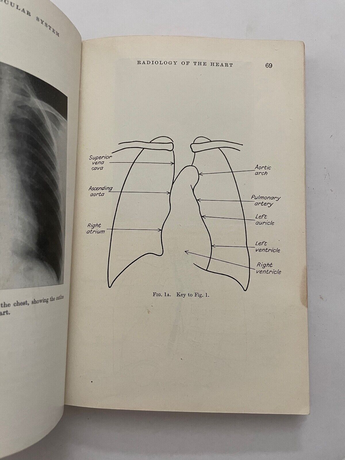 Clinical Examination of Patients by Forbes and Mann