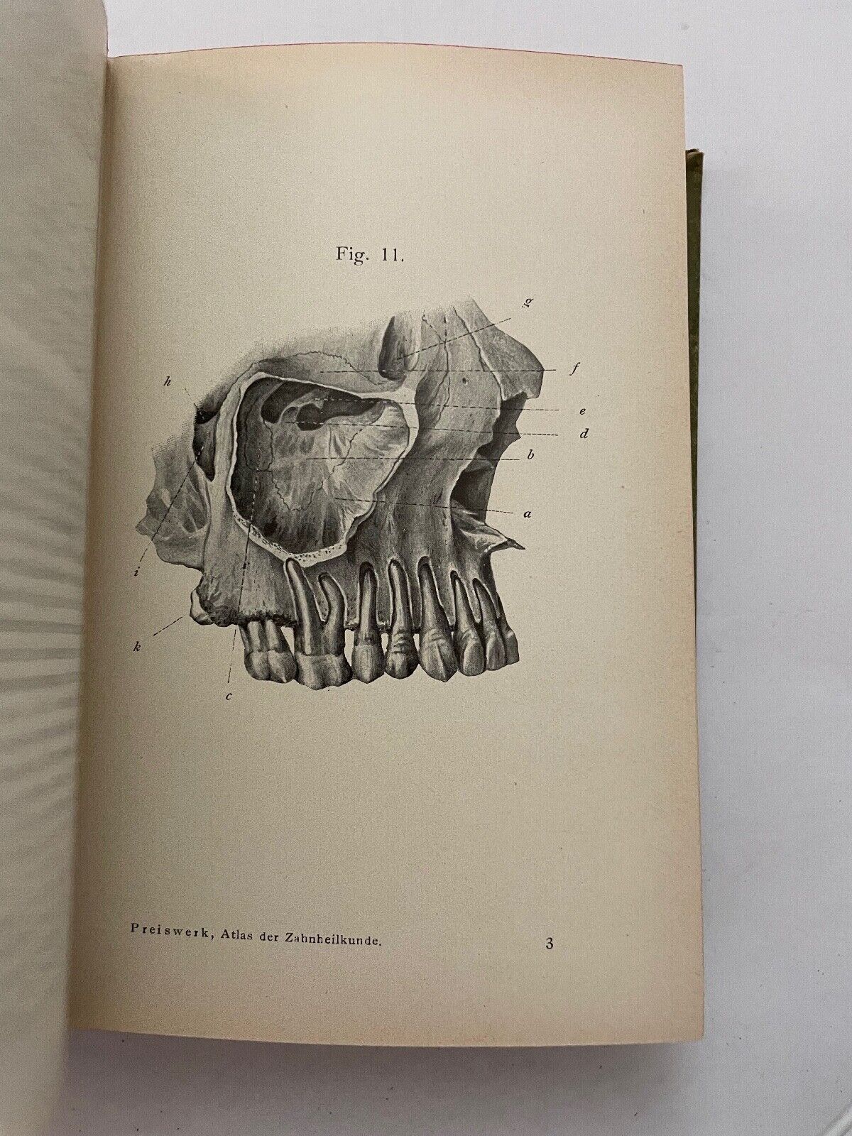 Dentistry Zahnheilkunde von G. Preiswerk (German)
