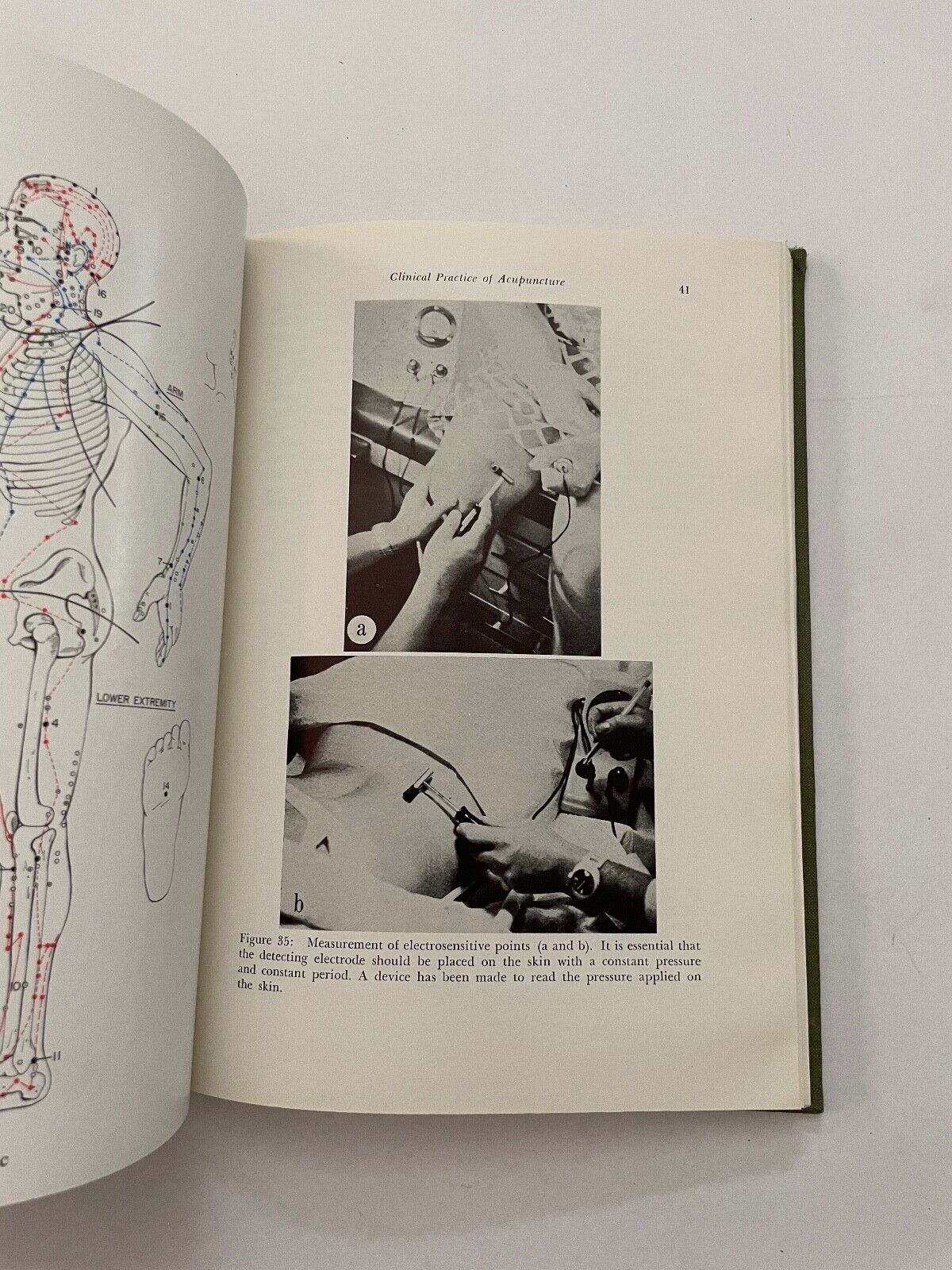 Acupuncture for Physicians by Teruo Matsumoto