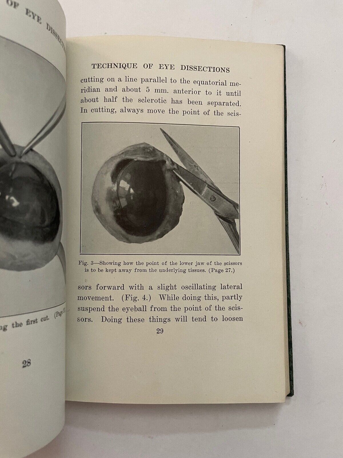 Technique of Eye Dissections by Frederic A Woll