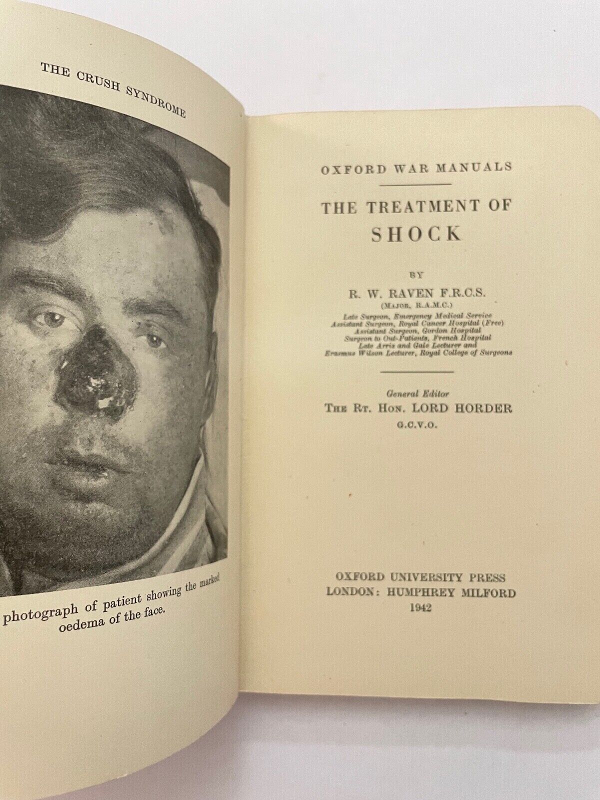 The Treatment of Shock (Oxford War Manuals) by RW Raven