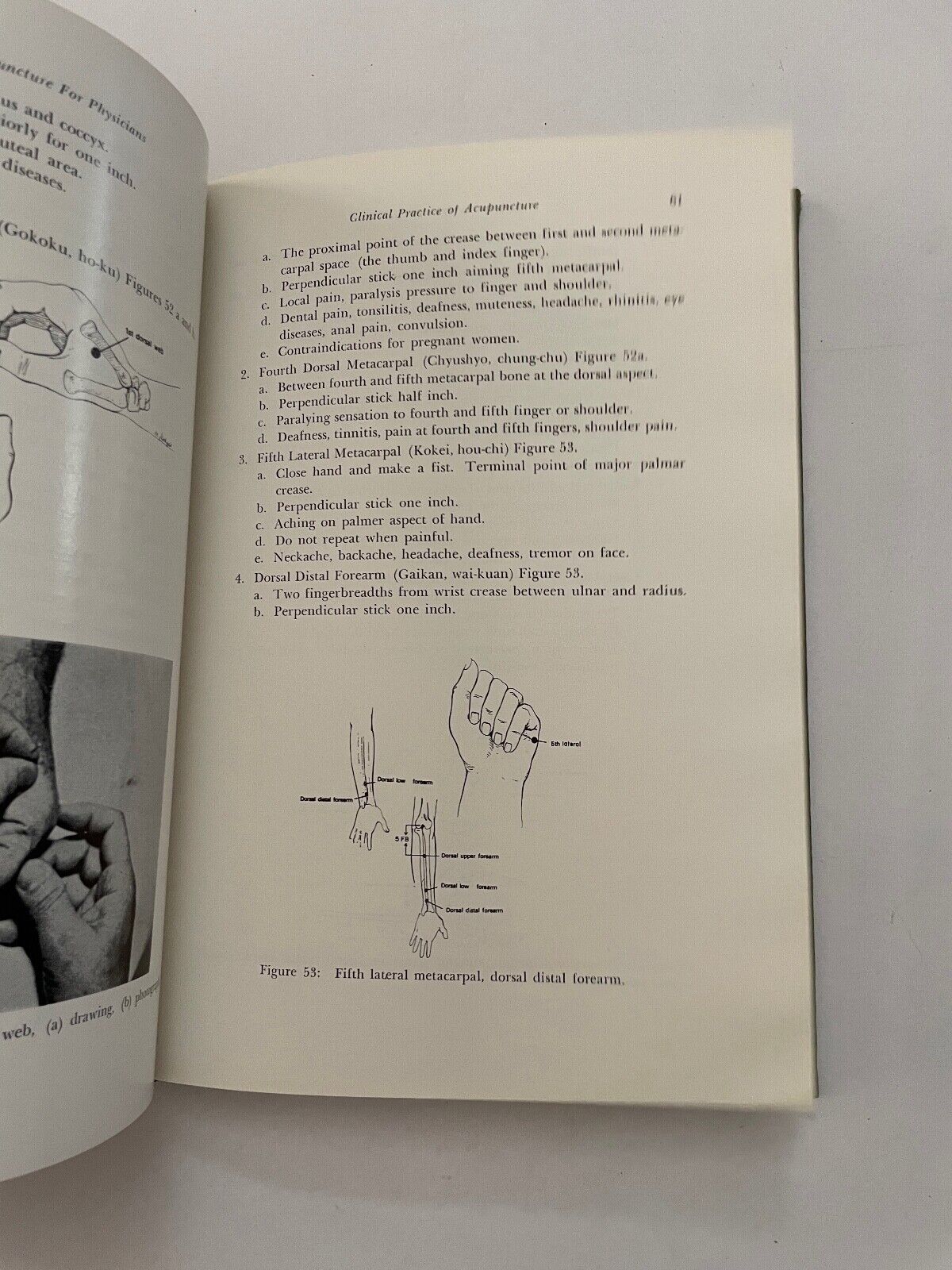 Acupuncture for Physicians by Teruo Matsumoto