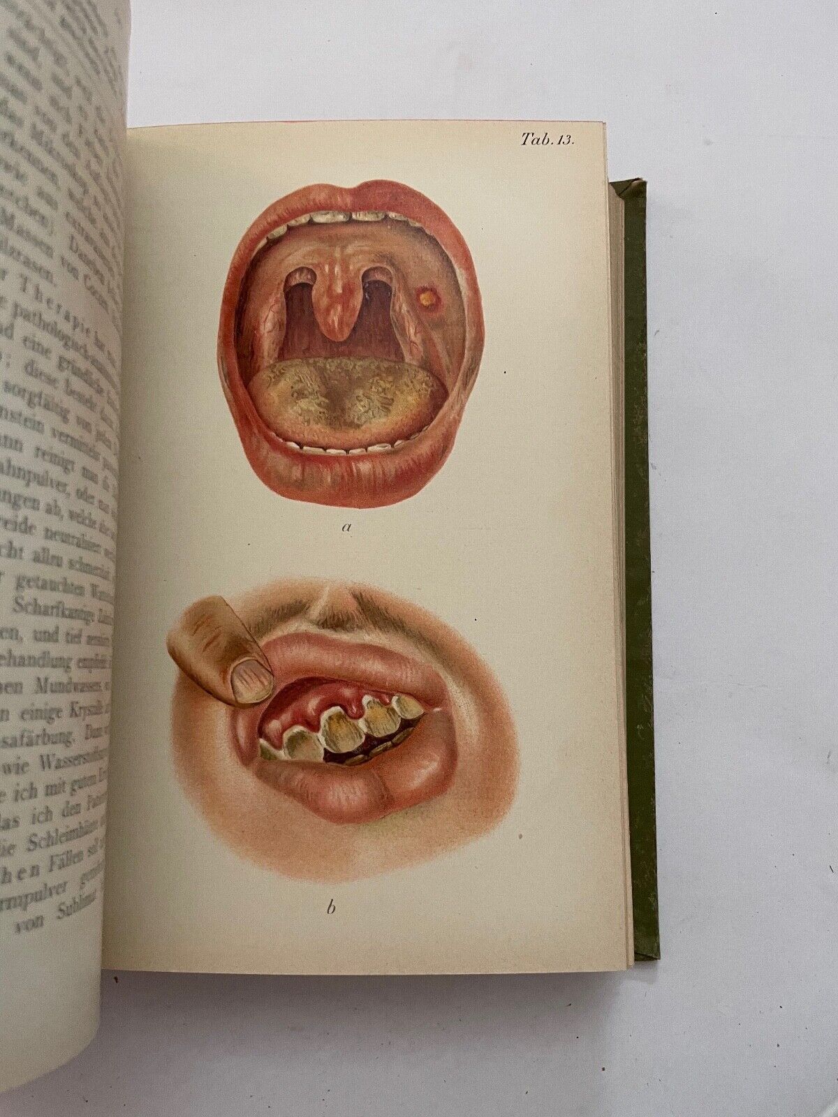 Dentistry Zahnheilkunde von G. Preiswerk (German)