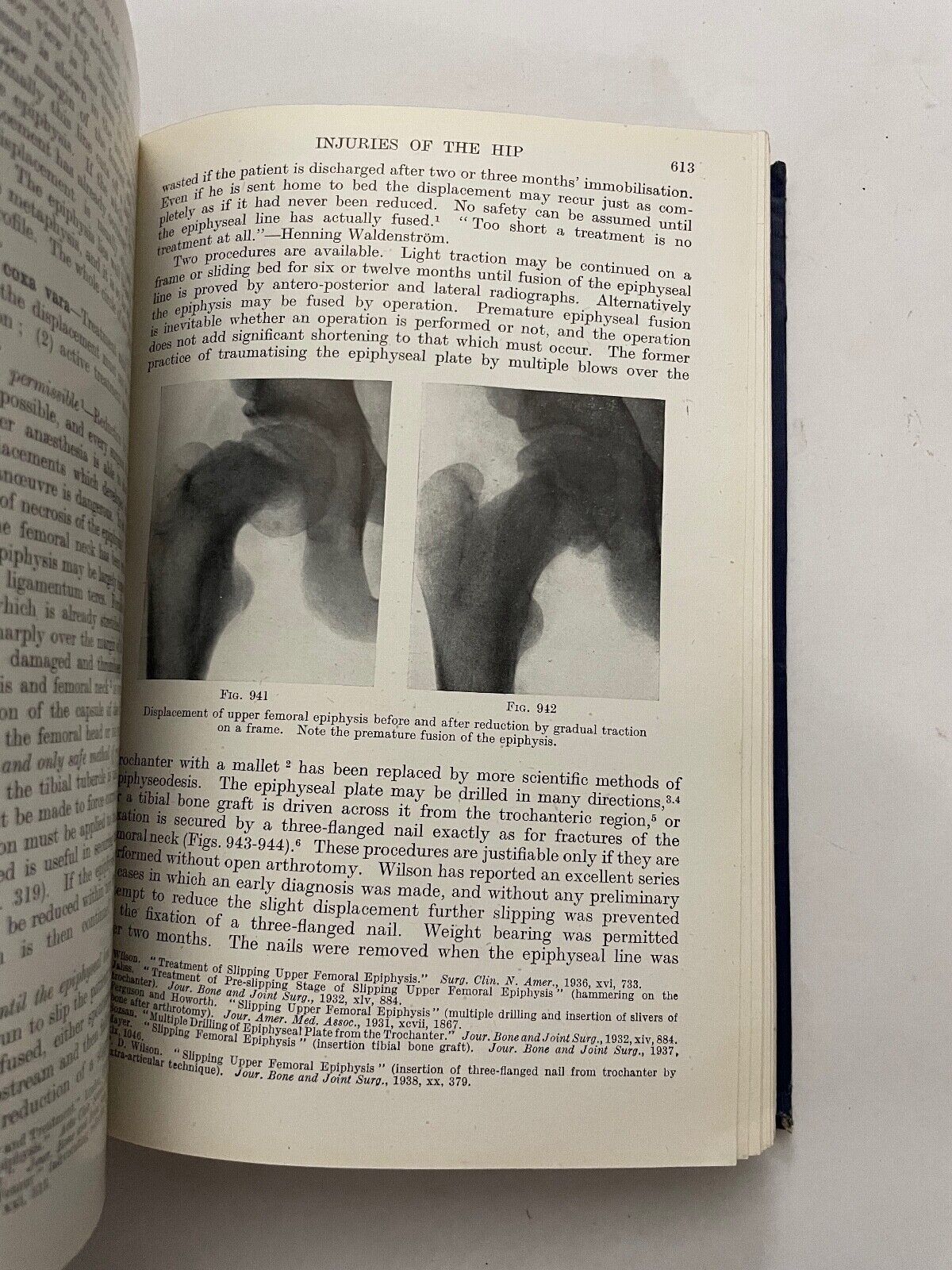 Fractures and Joint Injuries by Reginald Watson-Jones