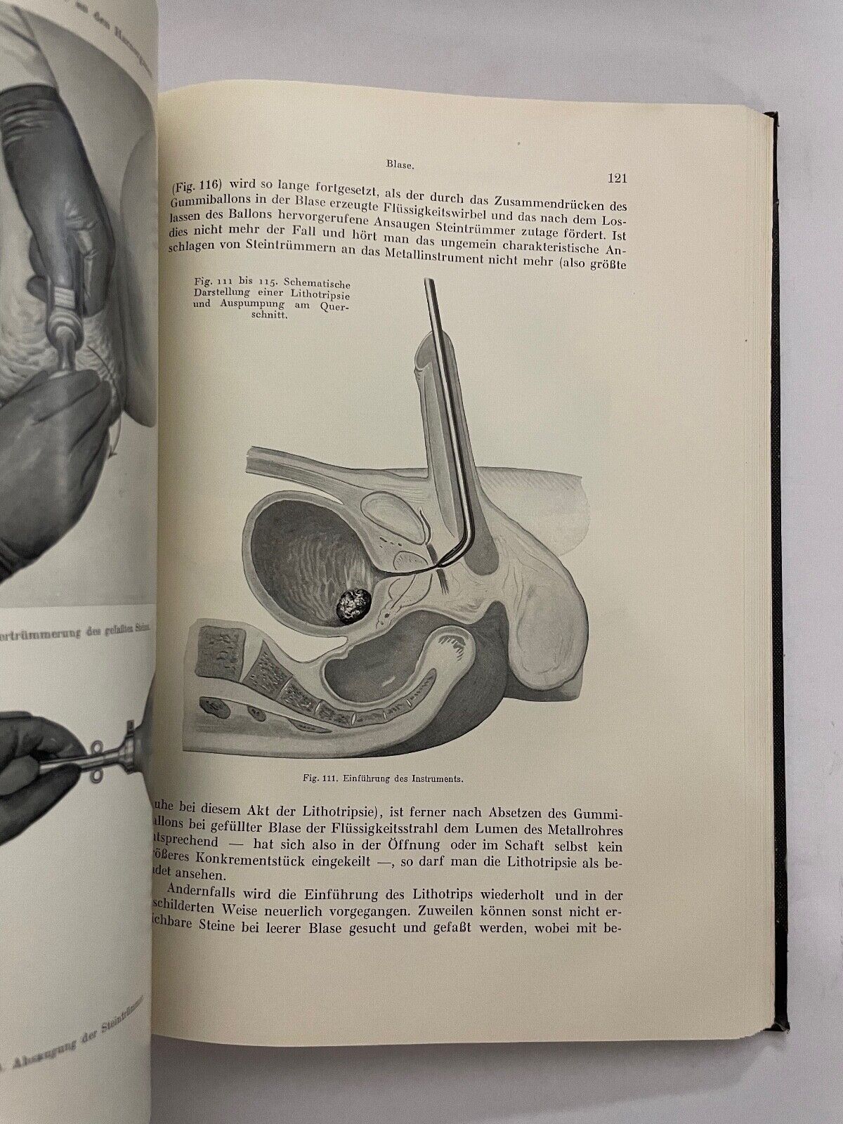 Urologische Operationslehre Dr Robert Lichtenstern