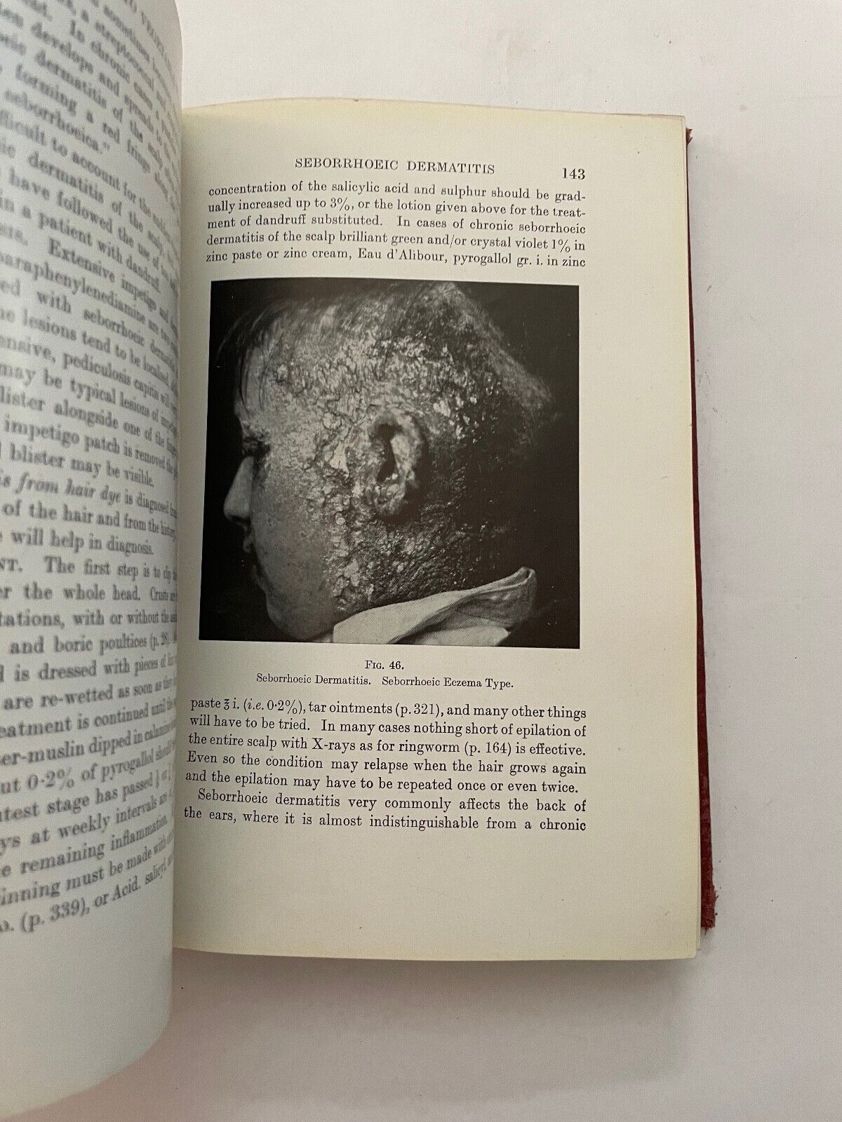 Common Skin Diseases by AC Roxburgh 7th edition