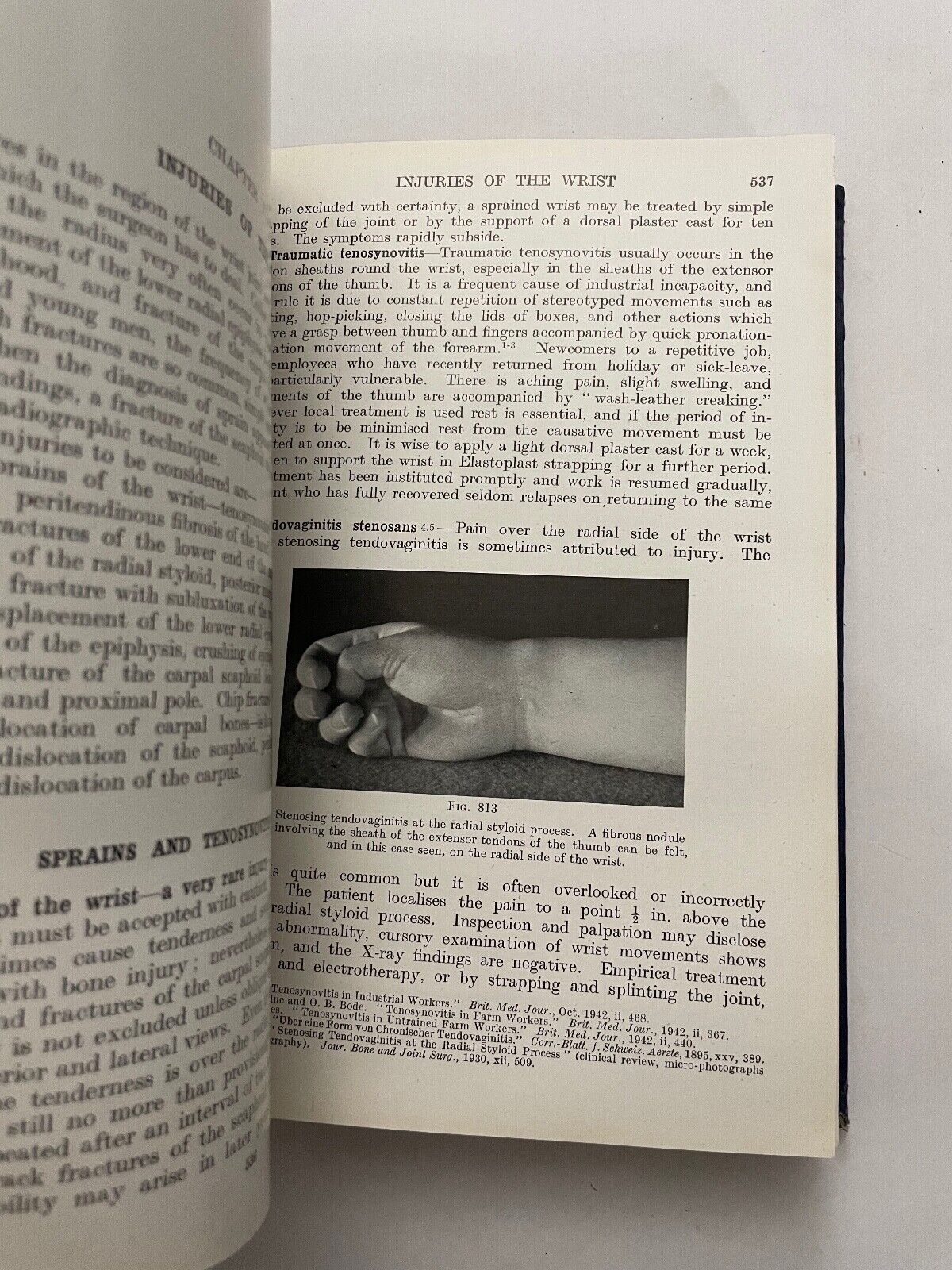 Fractures and Joint Injuries by Reginald Watson-Jones