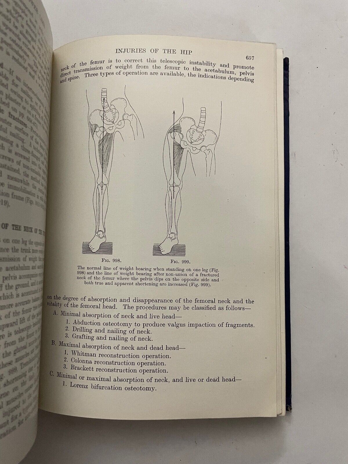 Fractures and Joint Injuries by Reginald Watson-Jones