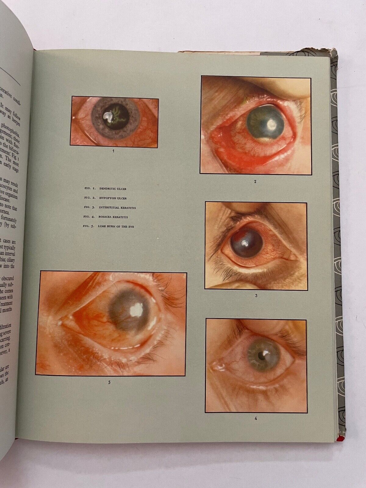 An Atlas of Diseases of the Eye by Perkins and Hansell 1961