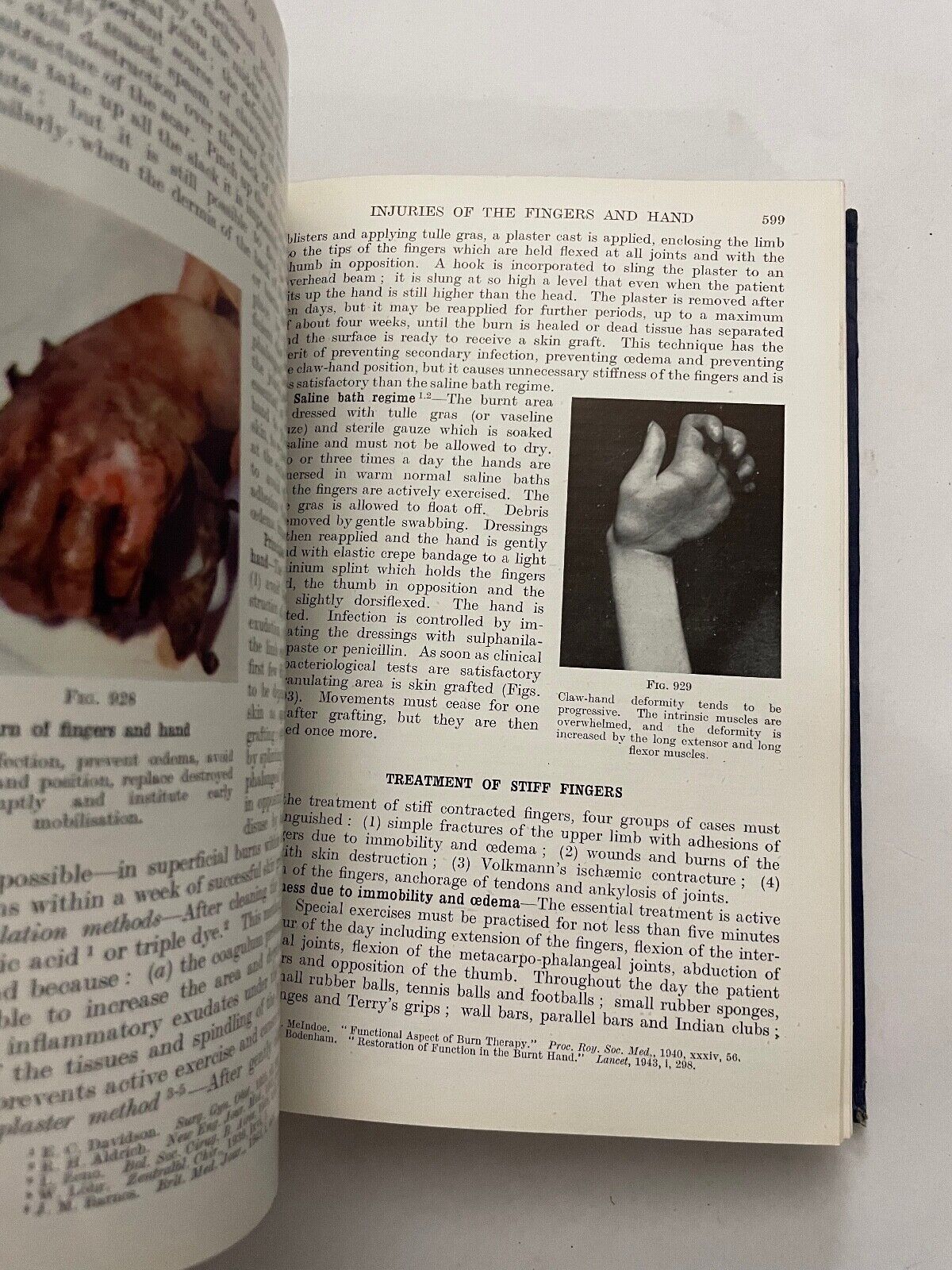 Fractures and Joint Injuries by Reginald Watson-Jones