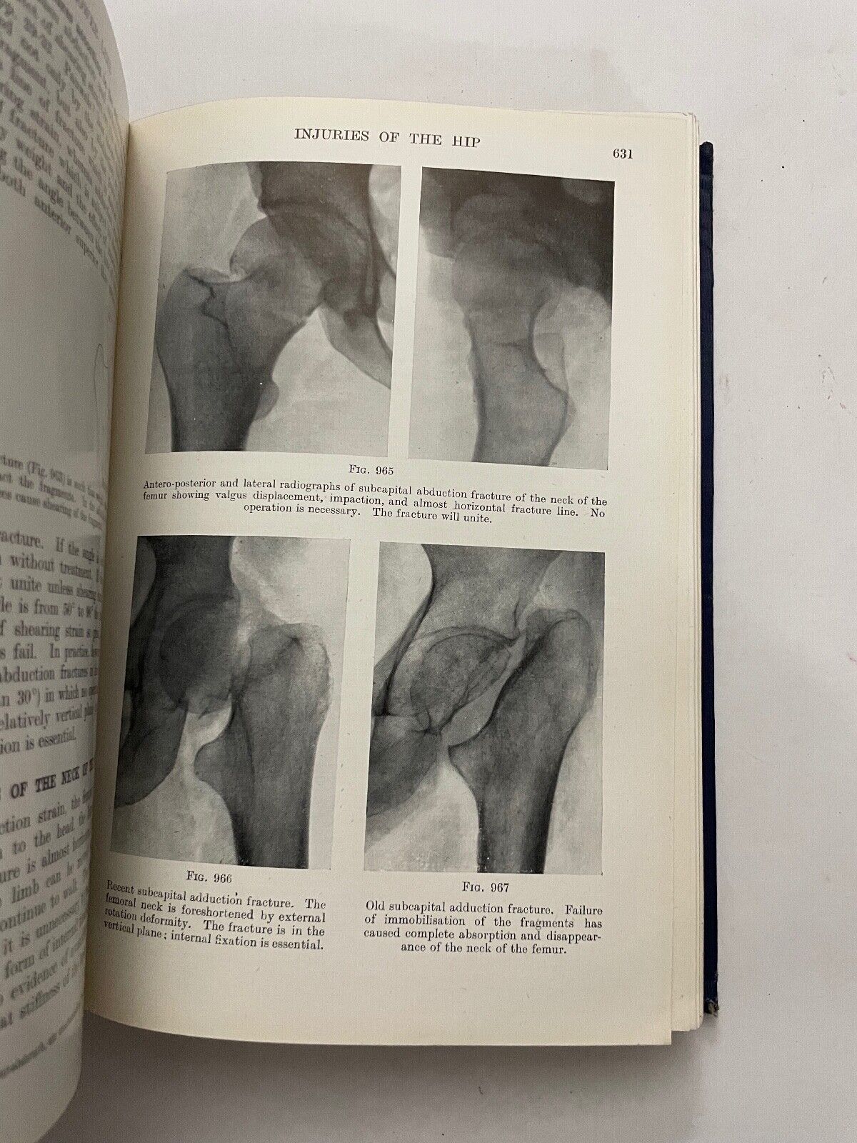 Fractures and Joint Injuries by Reginald Watson-Jones