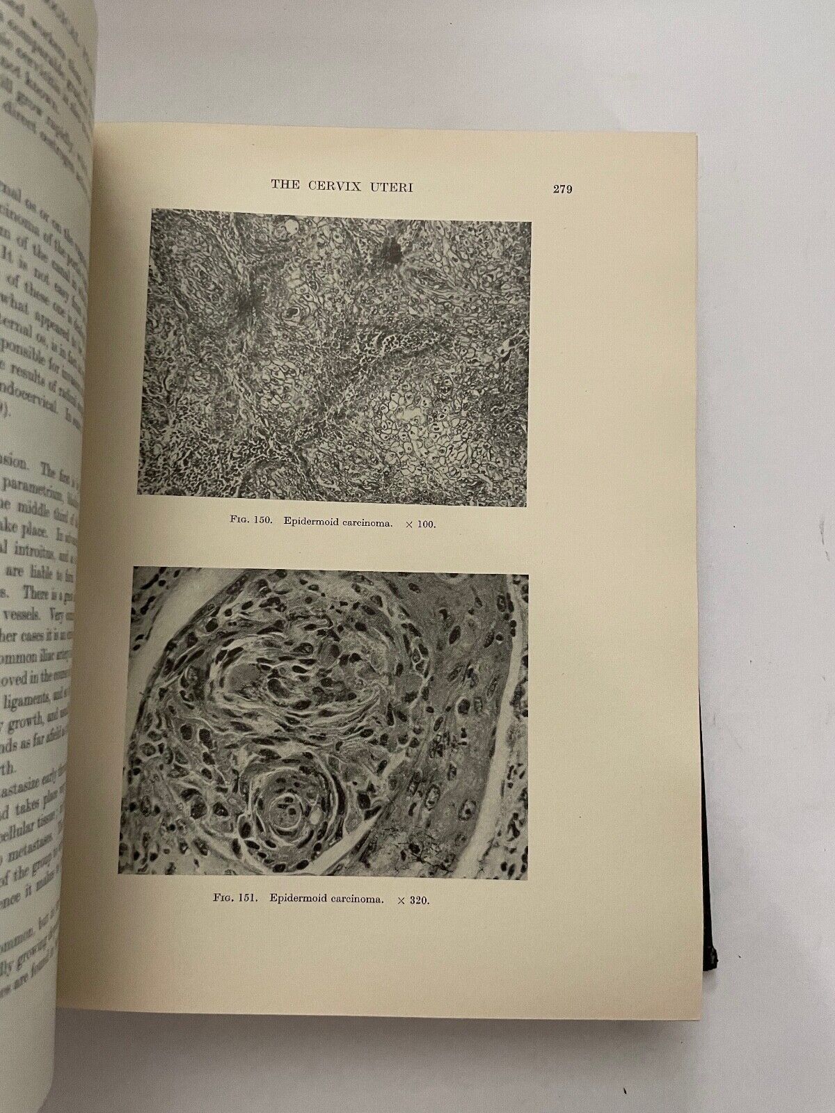 British Obstetric and Gynaecological Practice by Eardley Holland