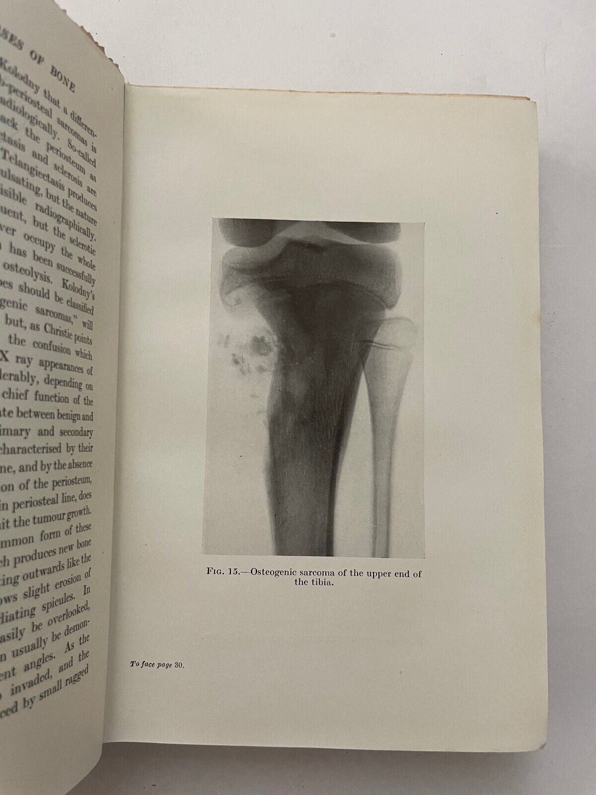 Recent Advances in Radiology Kerley