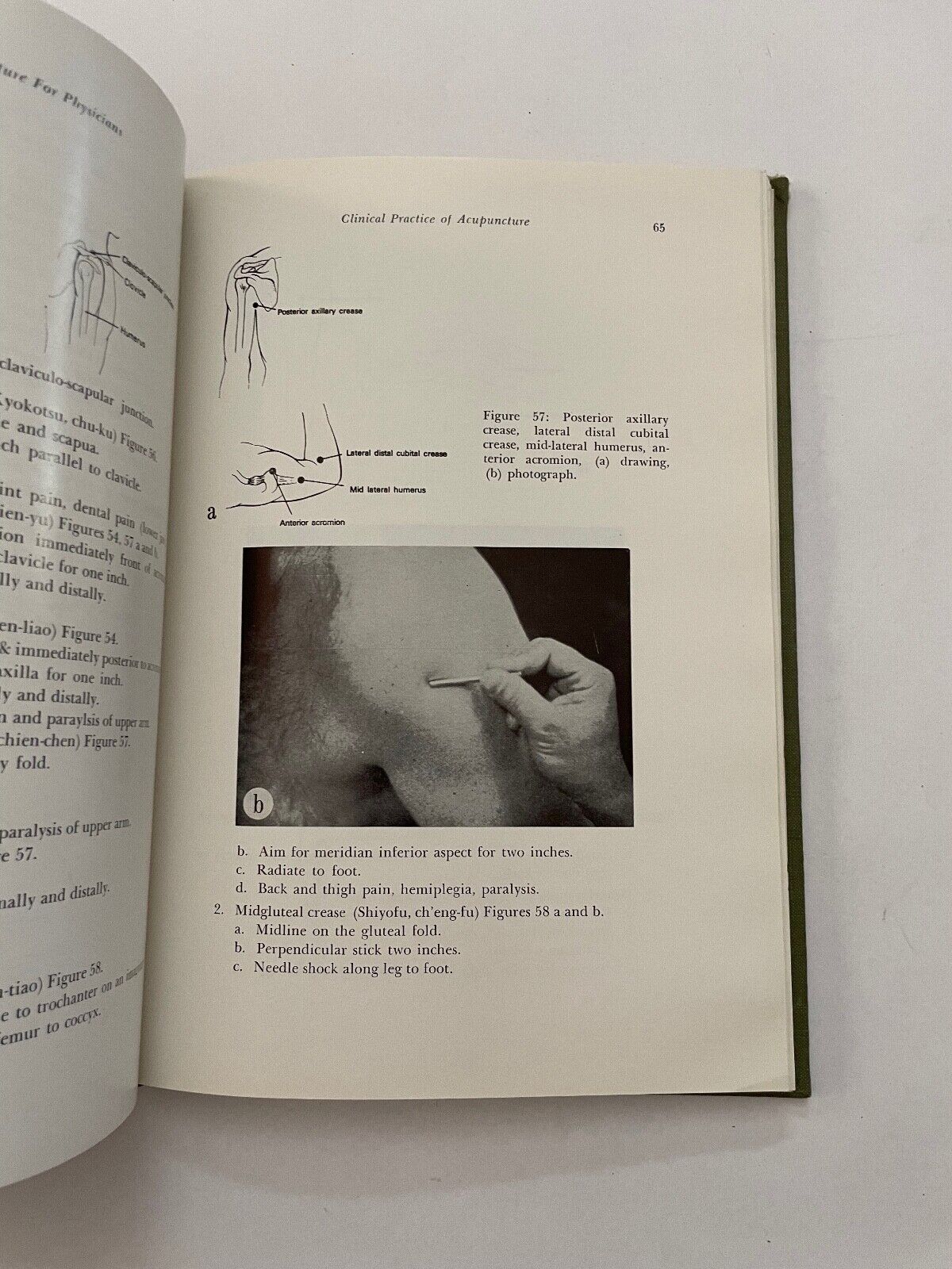 Acupuncture for Physicians by Teruo Matsumoto