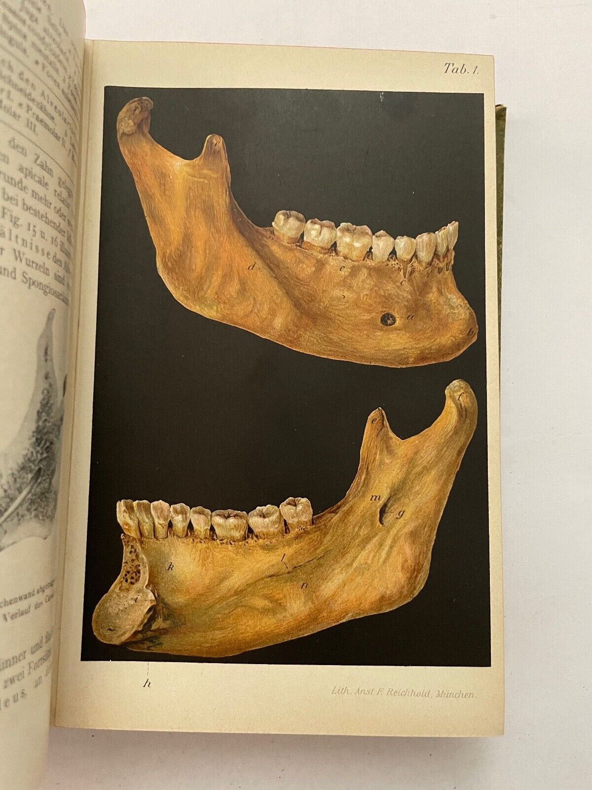 Dentistry Zahnheilkunde von G. Preiswerk (German)