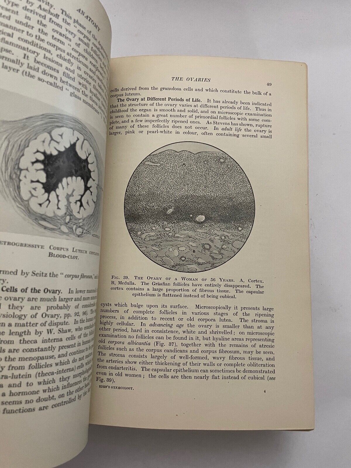 Eden and Lockyer's Gynaecology by Beckwith and Whitehouse
