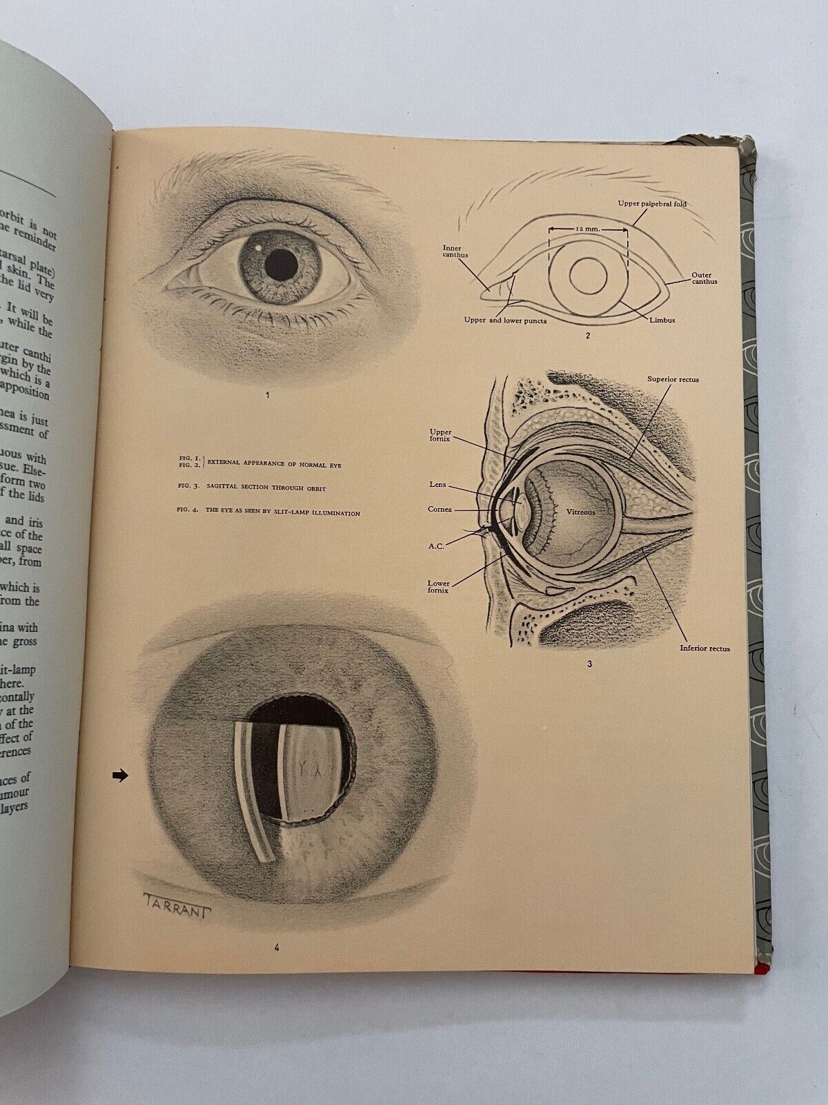 An Atlas of Diseases of the Eye by Perkins and Hansell 1961